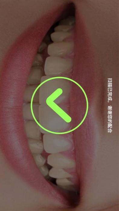 beyke iwhite官方版下载,beykeiwhite,牙科app,美白app